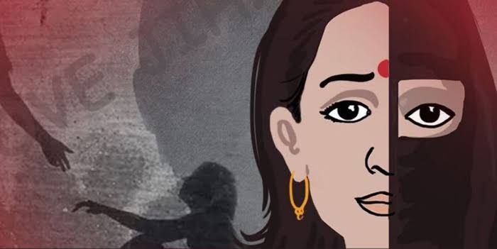 Representative Image Representative Image