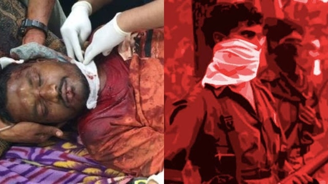 Representative Image Representative Image