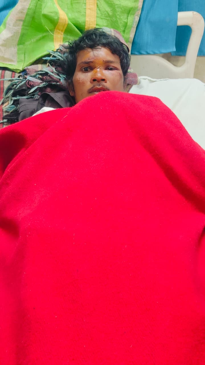 Representative Image Representative Image